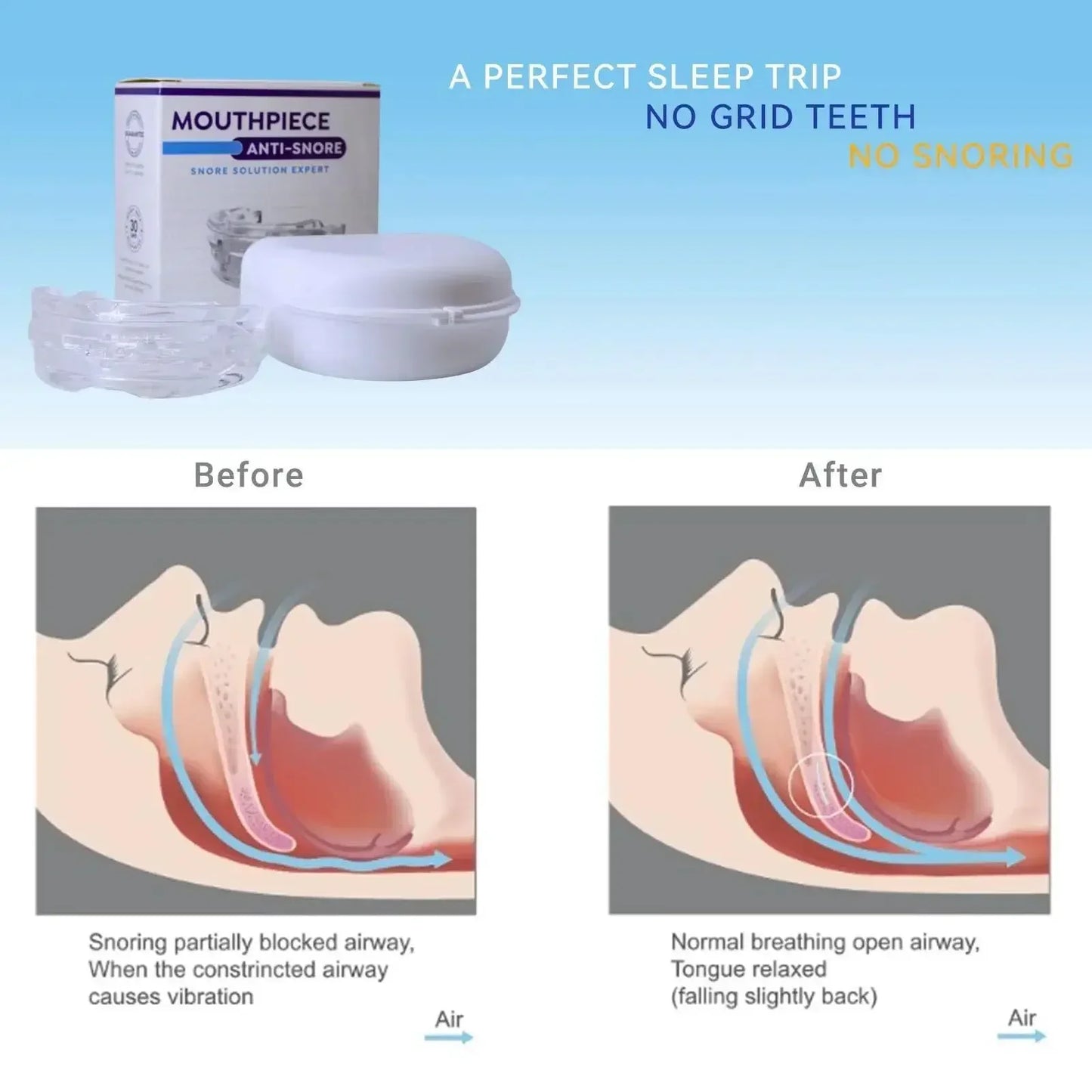 Adjustable Anti-Snoring Mouth Guard – Nighttime Teeth & Bite Guard